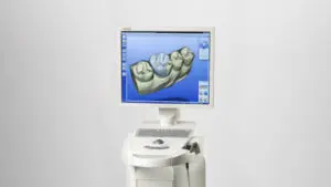 Computer with Dental Software on the screen