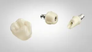 Dental Crowns