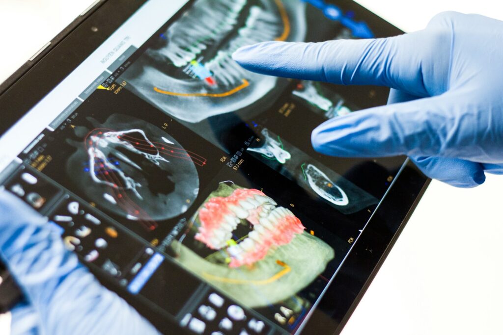 dentist wearing gloves pointing at cbct scan on tablet