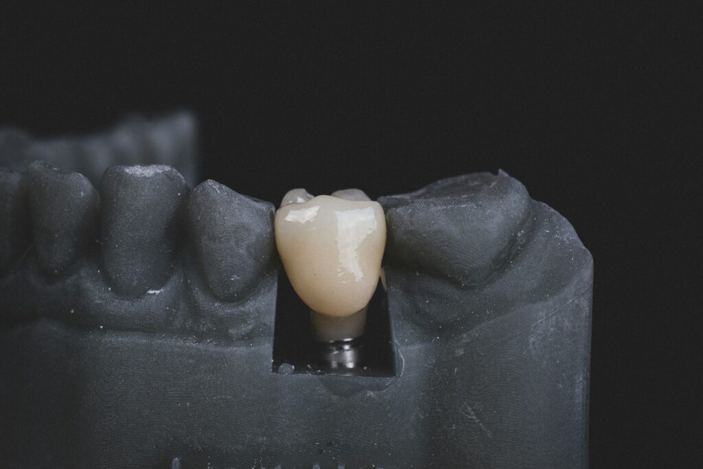 white dental implant in gray mouth mold