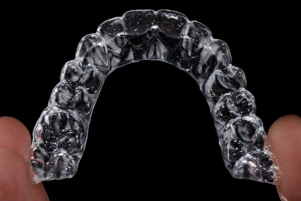 what to expect with clear aligners